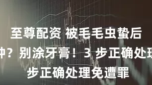 至尊配资 被毛毛虫蛰后又痒又肿？别涂牙膏！3 步正确处理免遭罪